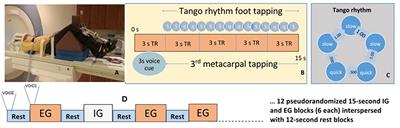 Internally Guided Lower Limb Movement Recruits Compensatory Cerebellar Activity in People With Parkinson's Disease